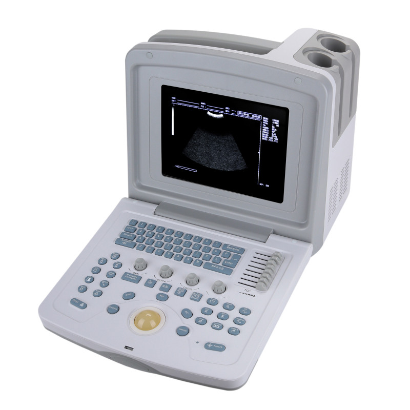 УЗИ сканер Med-Mos CMS600B3