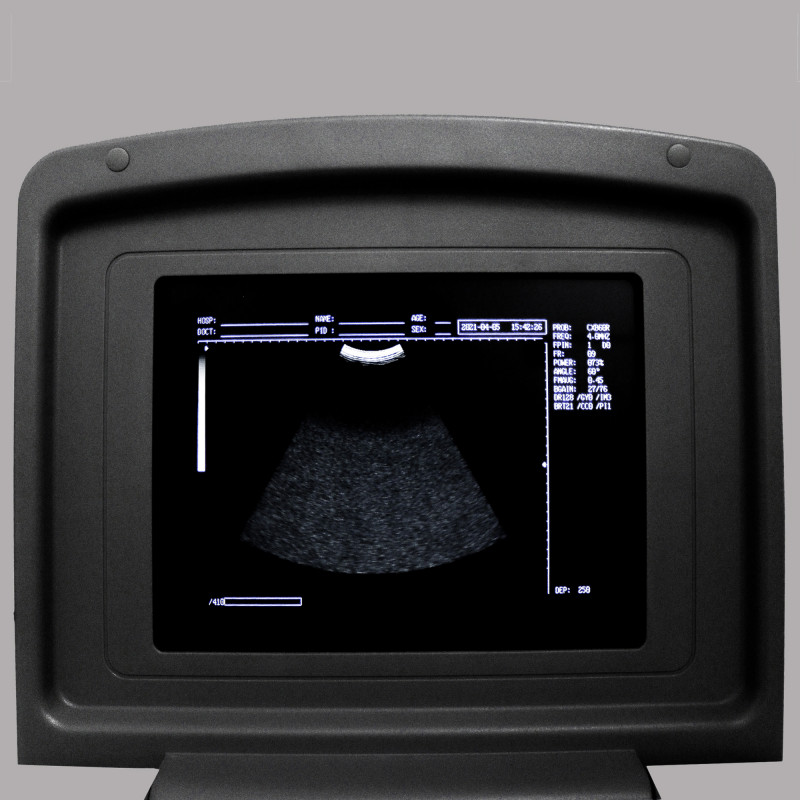 УЗИ сканер Med-Mos CMS600B3