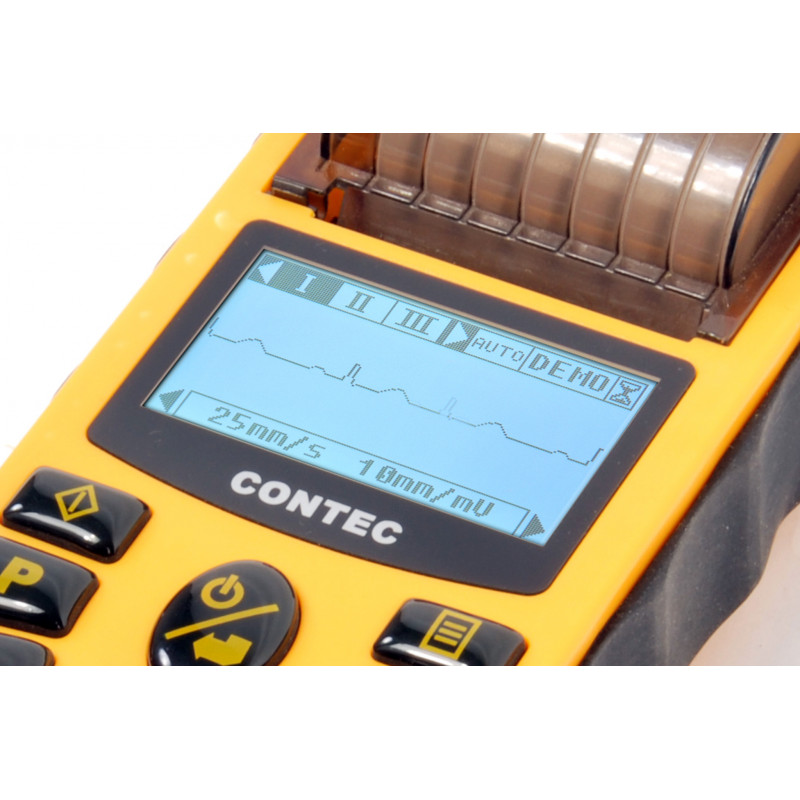 Электрокардиограф ECG80A